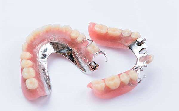 A photograph of custom partial dentures featuring metal frameworks, pink acrylic bases, and realistic artificial teeth against a clean white background.
