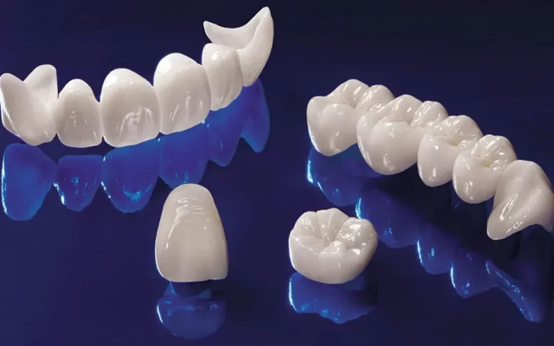A photograph of custom ceramic dental crowns and bridges displaying a polished white finish against a glossy dark blue background.