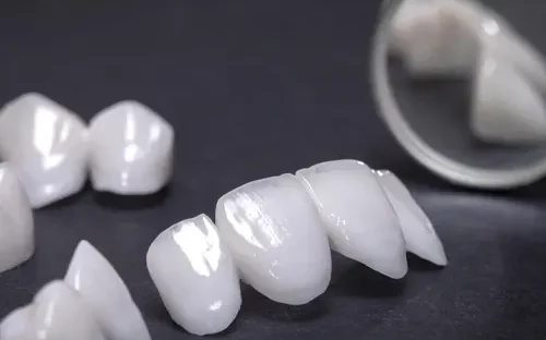 A close-up studio photograph of several custom white dental veneers or crowns arranged on a dark surface, with a dental mirror in the background reflecting additional pieces.