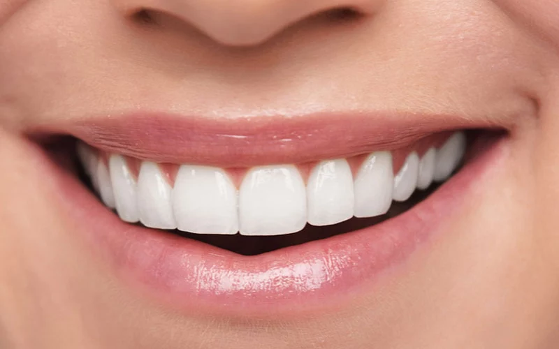 A close-up photograph of a bright, healthy, and natural smile showcasing white teeth and lips.