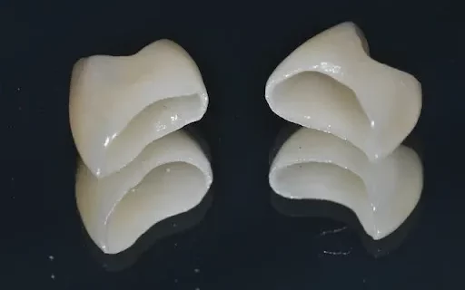 A close-up studio photograph of two custom ceramic dental crowns displayed on a dark reflective surface.