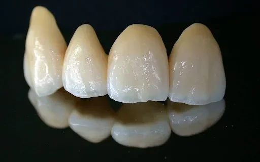 A close-up studio photograph of a row of four custom ceramic dental crowns arranged against a dark reflective surface.