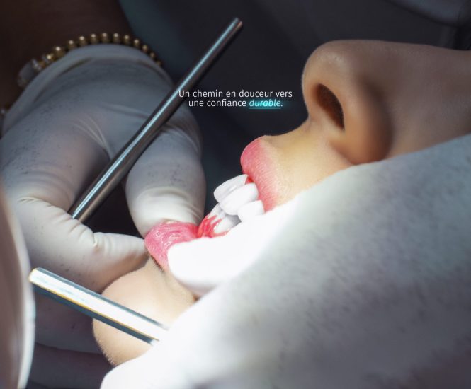 meilleur-dentiste-marrakech-traitement-canal-marrakech-dentiste-enfant-marrakech-rendez-vous-dentiste-marrakech-cabinet-dentaire-gueliz-marrakech-morocco-soins-dentaires